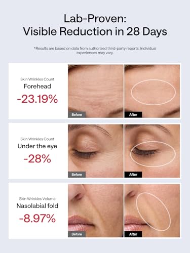 Facial Toning Device, Microcurrent Facial Device, Red Light Therapy, 4 Modes, 5 Intensity Levels D365