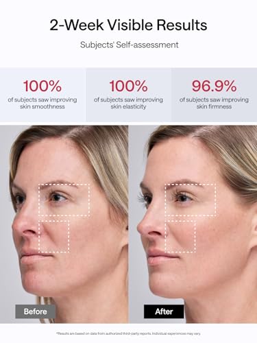 Facial Toning Device, Microcurrent Facial Device, Red Light Therapy, 4 Modes, 5 Intensity Levels D365