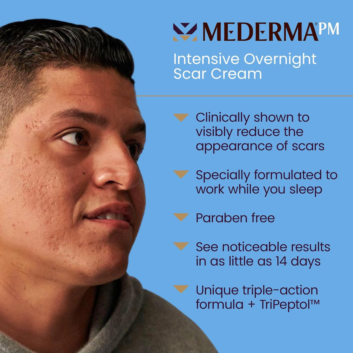 Intensive Overnight Scar Cream, 1.0 Oz W732